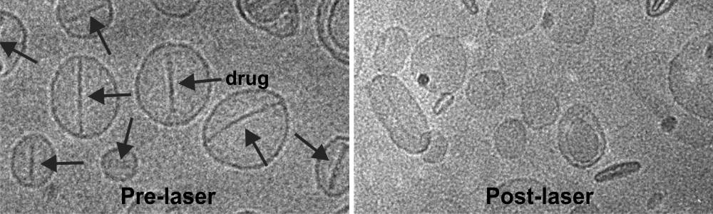 PoP liposomes